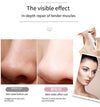 Blackhead Vacuum Remover — Electric Pore Cleanser