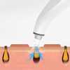Blackhead Vacuum Remover — Electric Pore Cleanser